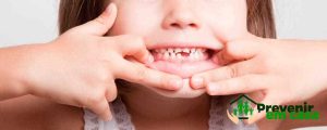 Meu-filho-quebrou-o-dente